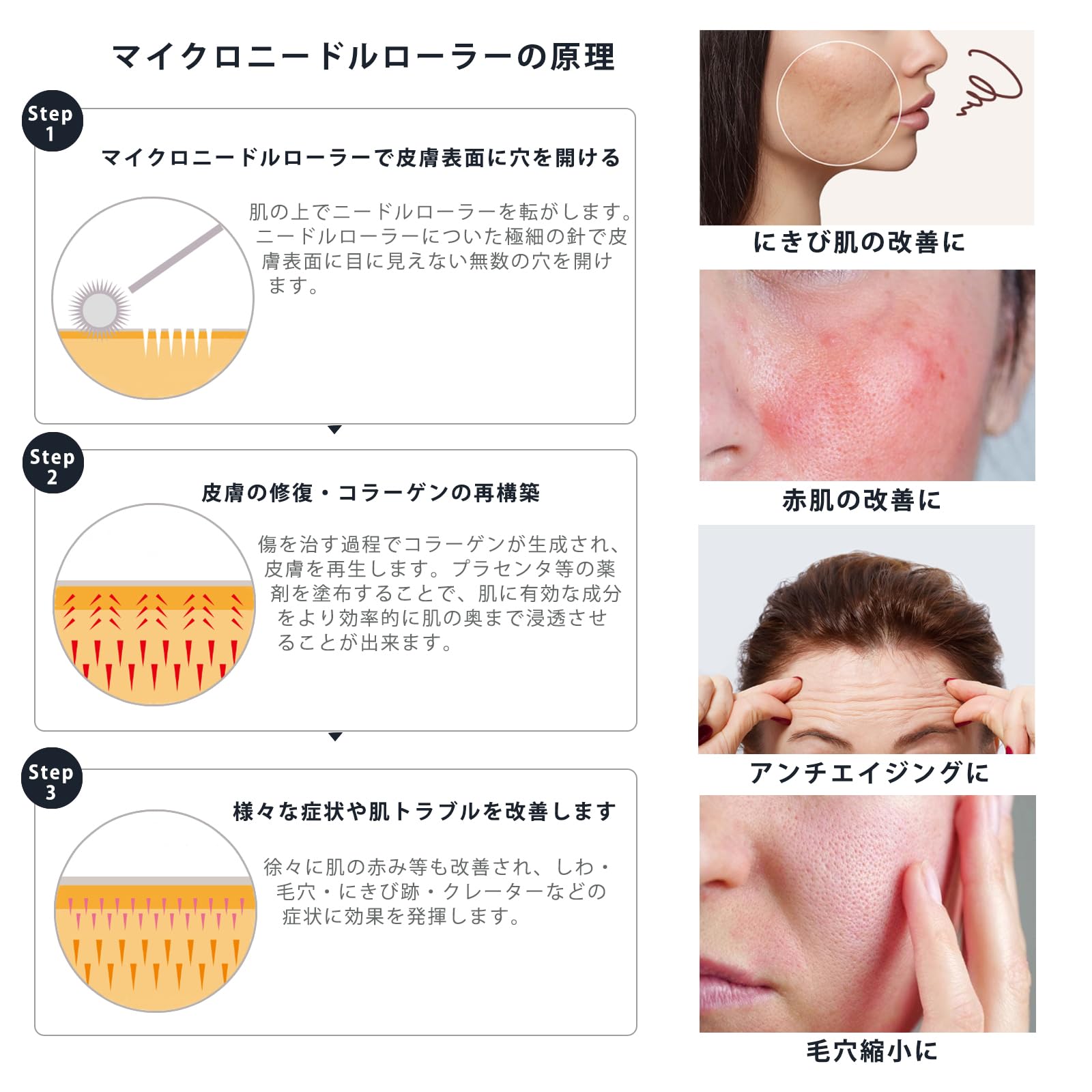 Amazon | ZIREE マイクロニードルローラー 0.5mm 美容ローラー 正規品