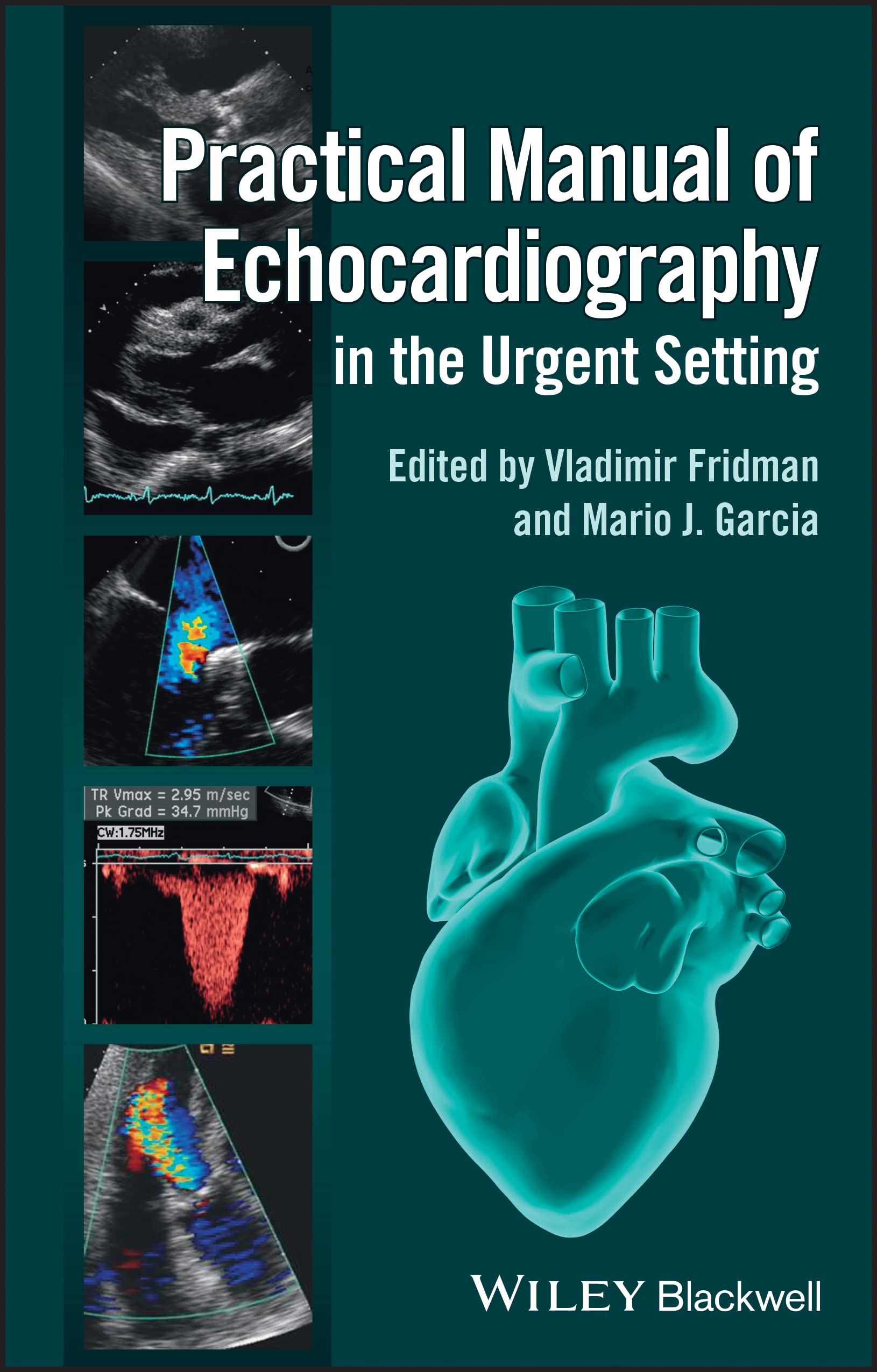 Buy Practical Manual Of Echocardiography In The Urgent Setting (Pb 2013) — BookShops.in