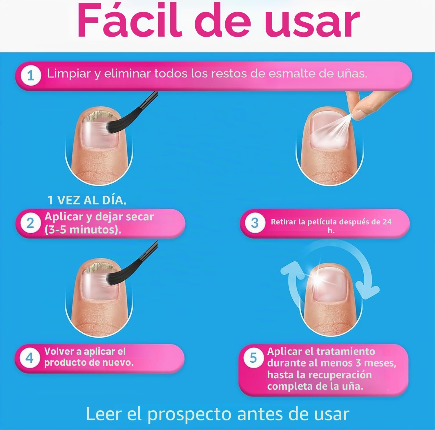 Excilor - Forte - Tratamiento de la micosis de las uñas - Contra la micosis de las uñas persistente - Fácil aplicación con pincel - Sin limar - Clínicamente probado - 30 ml