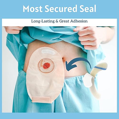 Miniatura 6 de 20 tiras elásticas de barrera para ostomía, cintas adhesivas hidrocoloides médicas para el cuidado del estoma, tira extensora de sello de barrera