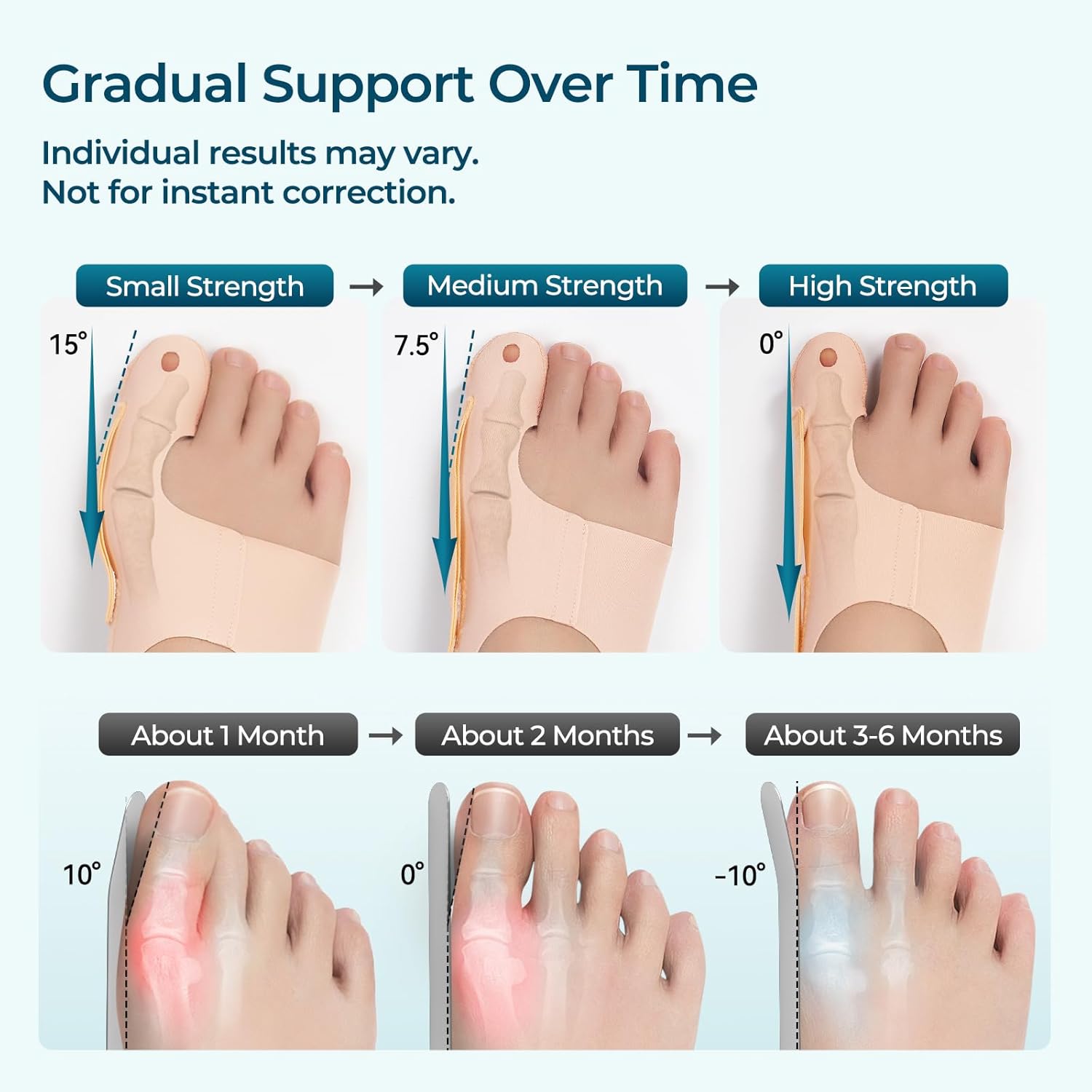 24-Hour Bunion Corrector Set – Day & Night Toe Alignment System, Soft Walking Sleeve + Night Splint for Sleeping, Big Toe Pain Relief & Gradual Support for Men & Women 2 Pairs(L)
