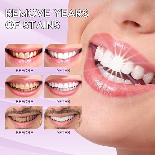 Miniatura 5 de Nivea Men Pasta de dientes morada, 1.06 onzas líquidas, gel blanqueador para dientes, unisex para adultos