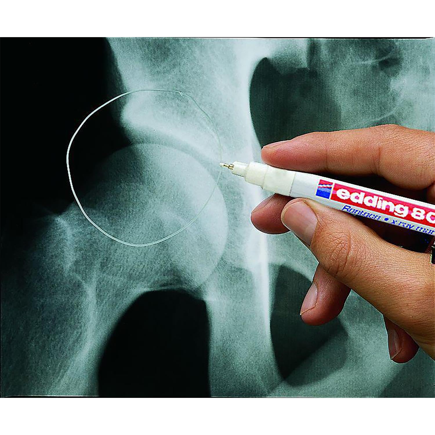 Edding Radiologie-Marker 8010, feine Spitze, 0,8 mm, Weiß, 5 Stück