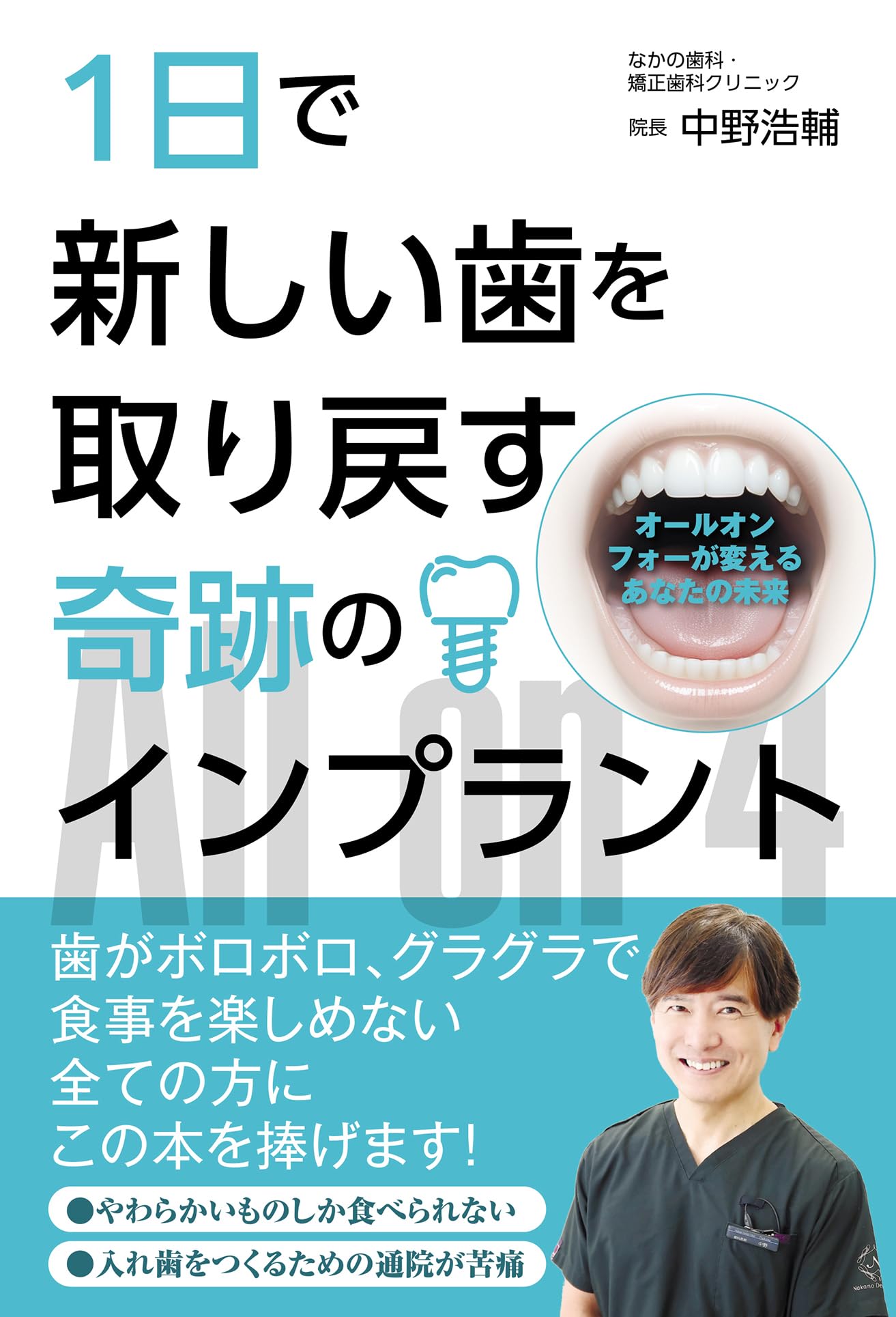1日で新しい歯を取り戻す奇跡のインプラント オールオンフォーが変える