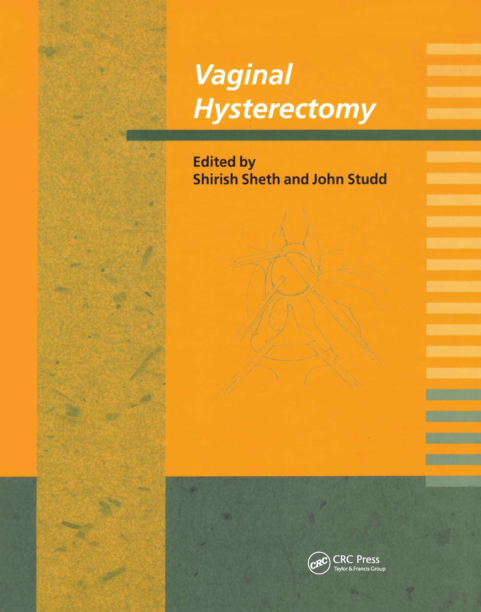Buy Vaginal Hysterectomy — BookShops.in