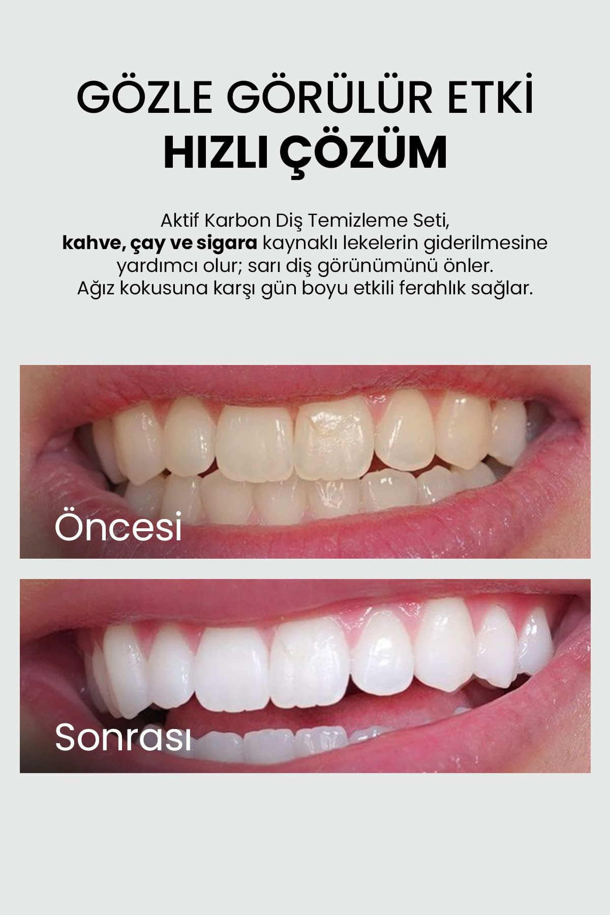 Luis Bien Diş Beyazlatıcı Set-Doğal Aktif Karbon Diş Macunu 75 ML+ Aktif Karbon Diş Beyazlatma Tozu 50 GR-Diş Sararmasına,Ağız Kokusuna Doğal Çözüm(1 adet 75 ml Diş Macunu+ 1 adet Diş Temizleme Tozu)