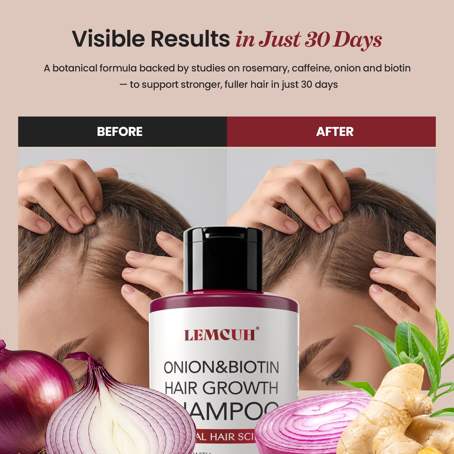 Champú para el crecimiento del cabello con cebolla y biotina: infundido con aceite natural de romero y árbol de té Tratamiento anti pérdida de cabello - El cuero cabelludo suaviza la fórmula para 3