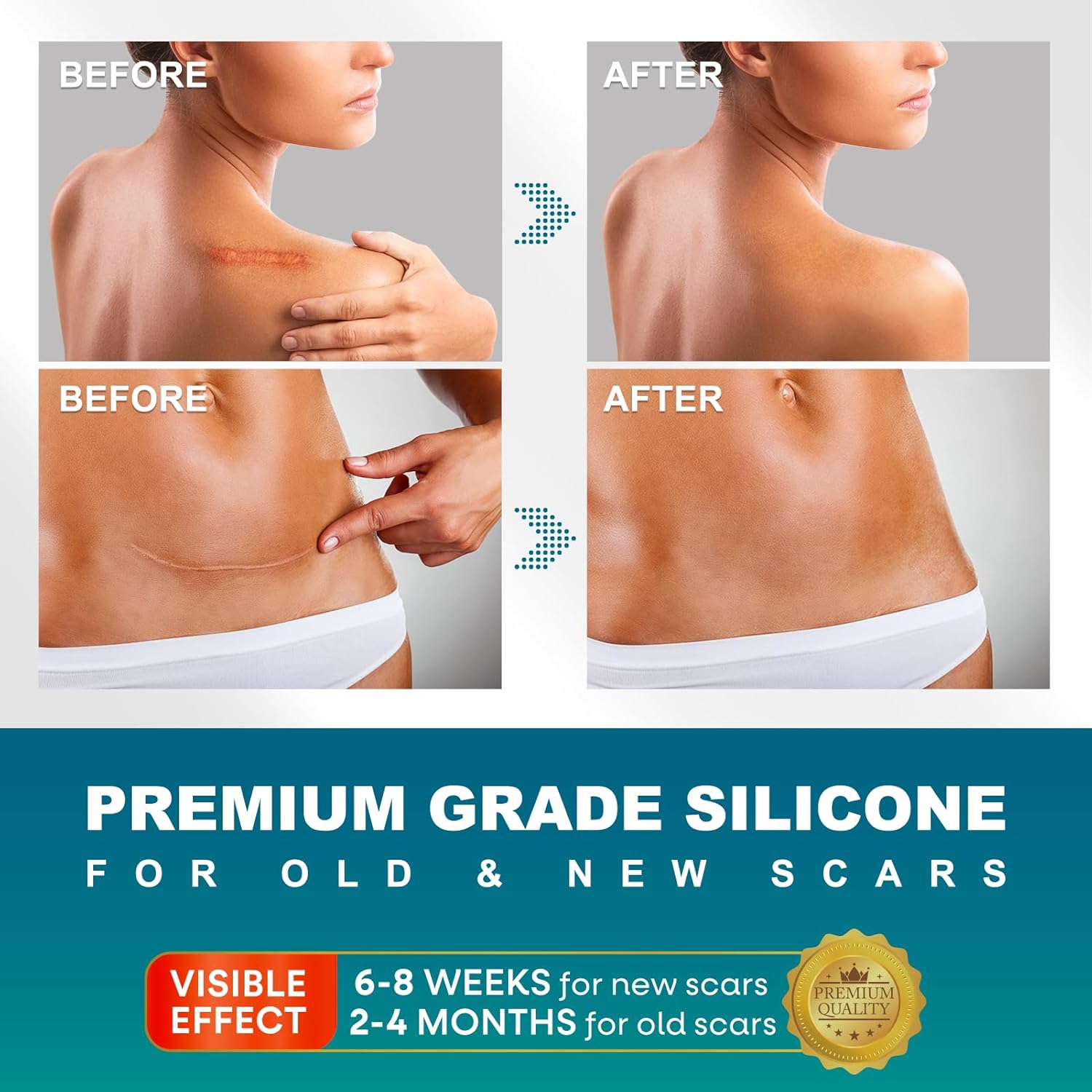 Silicone Scar Sheets, Silicone Scar Tape(1.6"x 120" Roll-300CM), Silicone Tape for Scars, Scar Tape for Surgical Scars, Silicone Scar Strips for C-Section, Tummy Tuck, Keloid, and Surgical Scars - Image 2