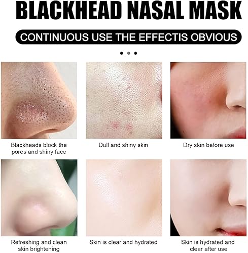 Miniatura 5 de Tiras de poros de nariz, máscara removedor de puntos negros, máscara removedora de cabeza negra y 60 tiras de nariz, máscara de limpieza profunda,