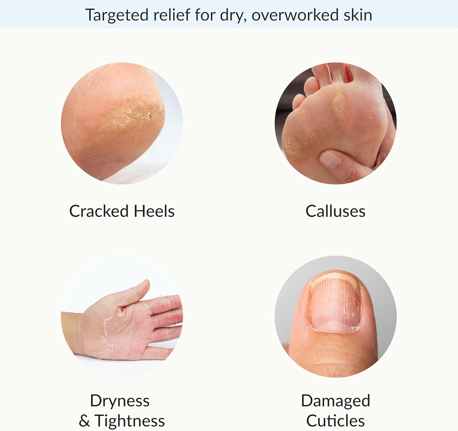 Epielle Intensive Repairing Hand & Foot Masks, Restore and Moisturize Dry, Cracked Skin, Self Care Gifts for Women, Spa Kit, Stocking Stuffers, 6 Moisturizing Gloves & 6 Moisturizing Socks - Image 6