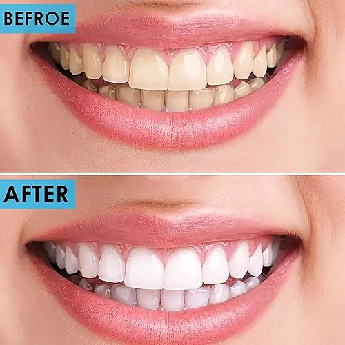 Miniatura 8 de Juego de herramientas dentales  Krisp Beauty profesional de acero inoxidable 4 piezas de púas dentales removedor de sarro de placa, raspador de