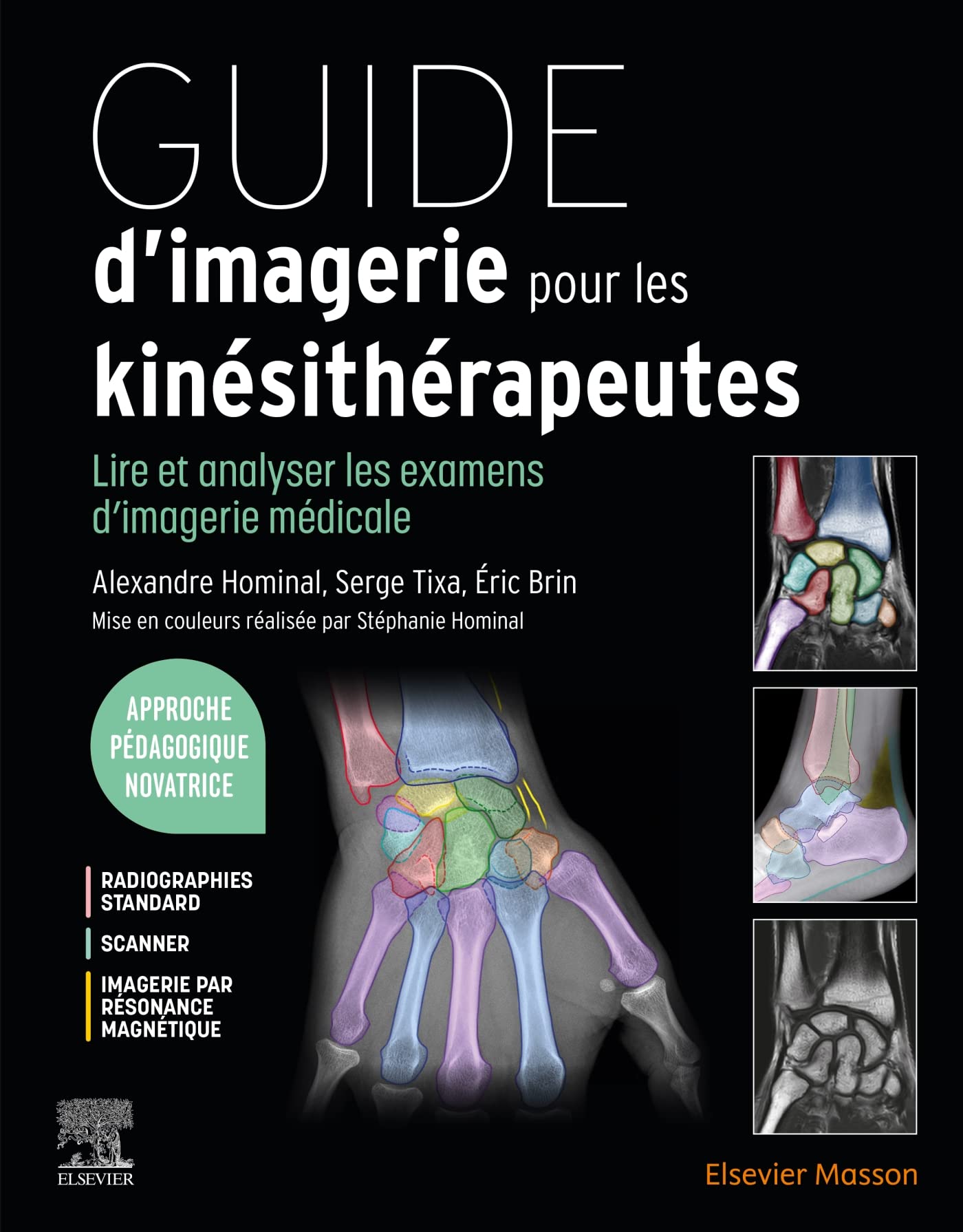 Guide d'imagerie pour les kinésithérapeutes: Lire et analyser les examens d'imagerie médicale