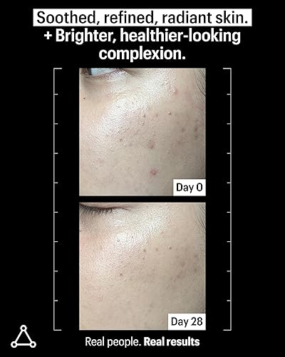 Miniatura 3 de Allies of Skin 20% Vitamina C Brighten + Suero Firme 20% ácido L-ascórbico etilado + Complejo de extracto de naranja con glutatión. Sin agua y