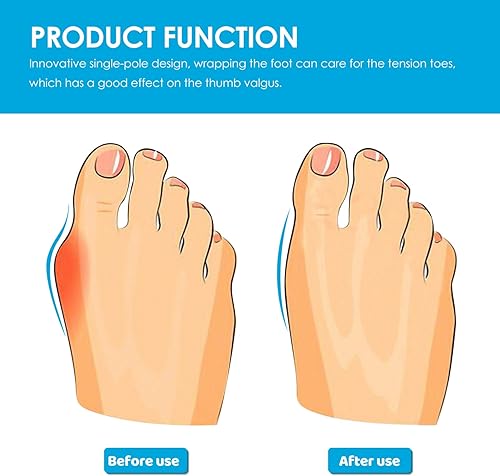 Miniatura 5 de minkissy 24 separadores de dedos de silicona para dedos de frutas, separadores de dedos reutilizables para arte de uñas, manicura, polaco, pedicura,