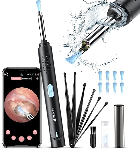 Eliminación de cera de oídos, kit de limpieza de oídos con 1080P, herramienta de eliminación de cera de oídos con cámara, otoscopio con luz,