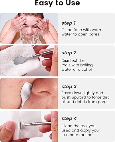 Miniatura 5 de Kit de herramientas para reventar espinillas, kit de 6 piezas de extracción de puntos negros, kit extractor de comedones con caja para eliminación
