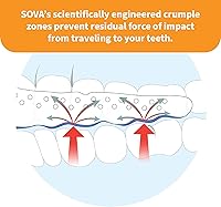 Vista 5 de SOVA Junior Night Guard, Blancanieves - 1.6mm de espesor - Ajuste moldeado a medida - Protege contra el rechinar y apretar de dientes nocturnos