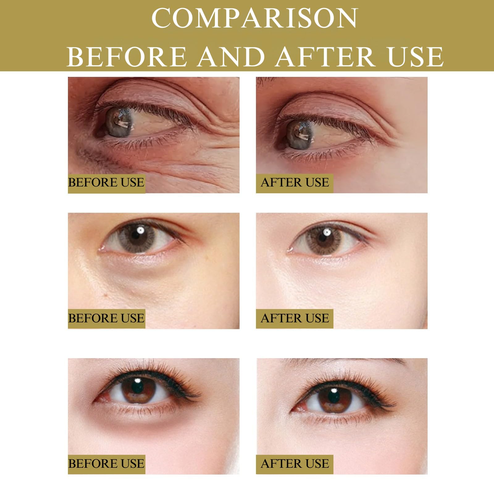 Nano Microneedle Patch for Eye,Dissolving Microneedle Eye Patches,Micro Needle Patches with Glycerin,Hyaluronic Acid-Anti-Wrinkle Under Eye Gel,Micro Needle Patches for Puffy Eyes&Dark Circles (8PCS) - Image 4
