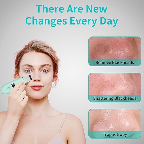 Miniatura 6 de Espátula facial para exfoliar la piel, herramienta de limpieza profunda 4 en 1 para extracción de poros, muelle de carga rápida, espátula facial