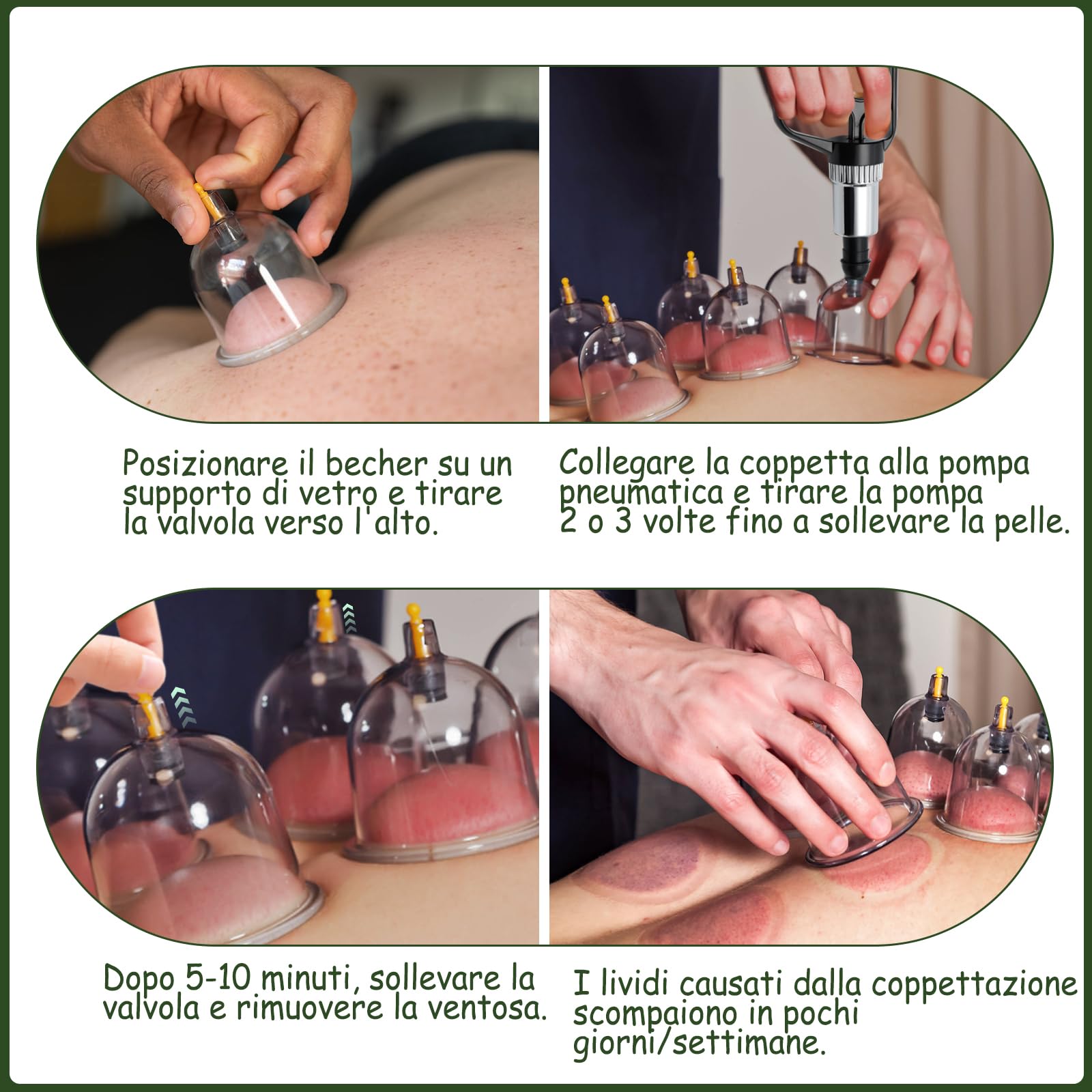 Professionale Coppettazione Massaggio Set, 22 Pezzi Coppettazione Con Pompa a Vuoto, Cupping Therapy Kit, Coppettazione Su Tutto Il Corpo, Coppetta Anticellulite Set