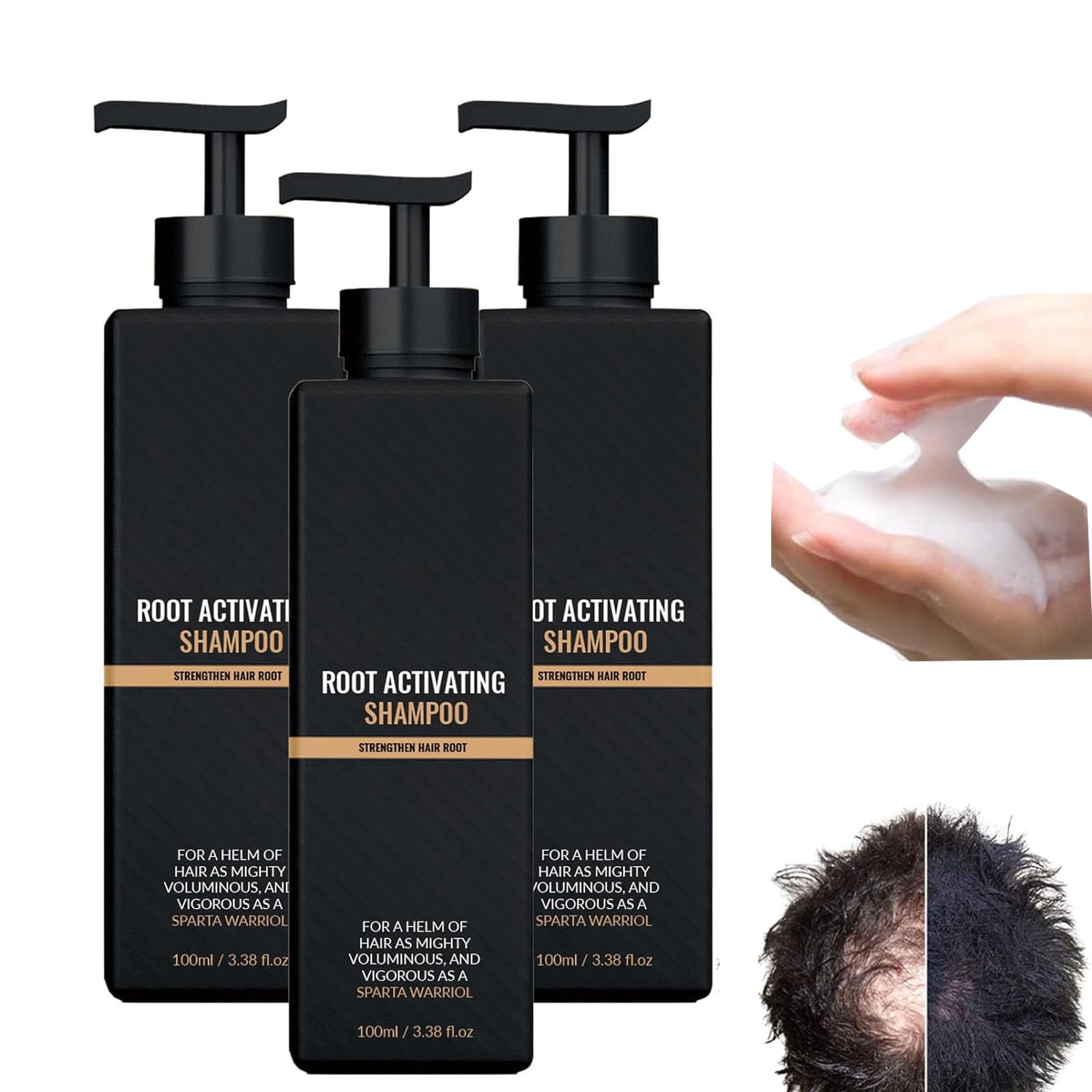 Root Activator SHAmpoo, 2023 New Hair Loss Shampoo, S-hampoo ROOT Activators, Mane R-oot Activator Shampoo, Accelerate Hair Growth (3pcs)