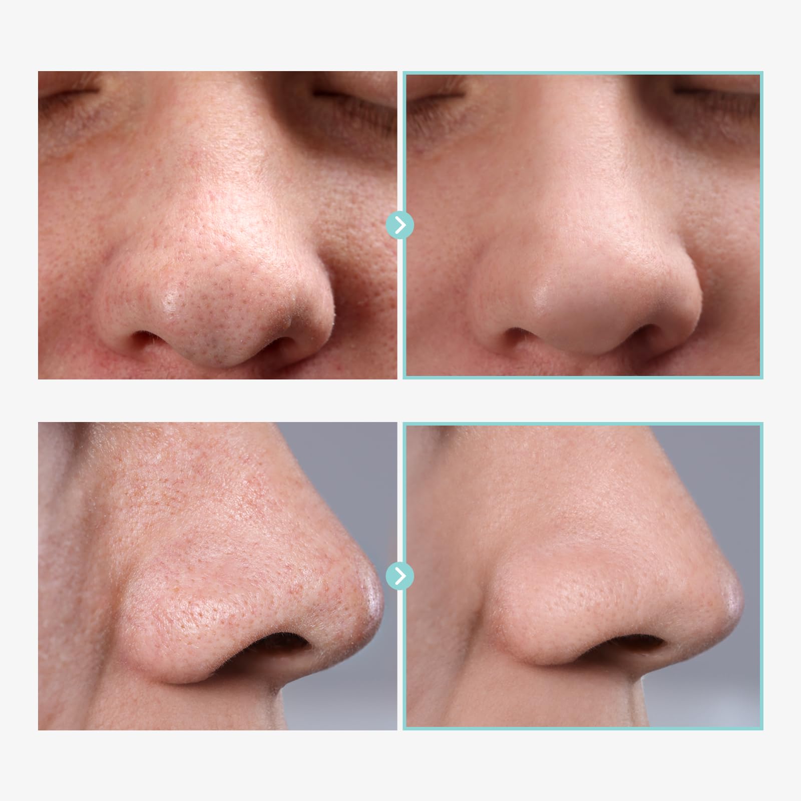 TOSOWOONG Pore Tightening Serum, Instantly Reduces Pores, Smooths Skin & Strengthens Barrier - Image 4