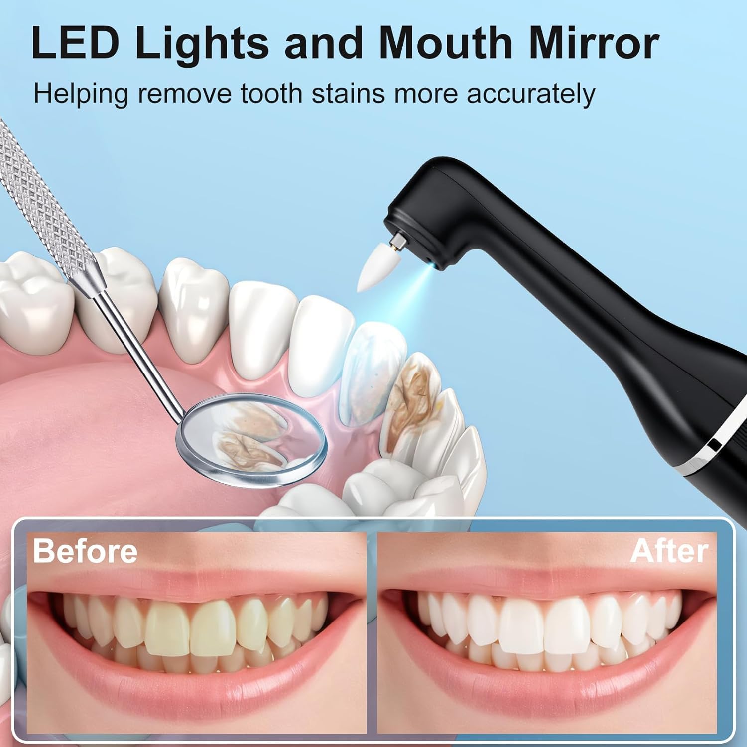 Set di Sbiancamento dei Denti, Kit per Pulizia dei Denti Elettrico,Lucidare Dopo la Pulizia,Sbiancamento, Riduce la Placca Nero