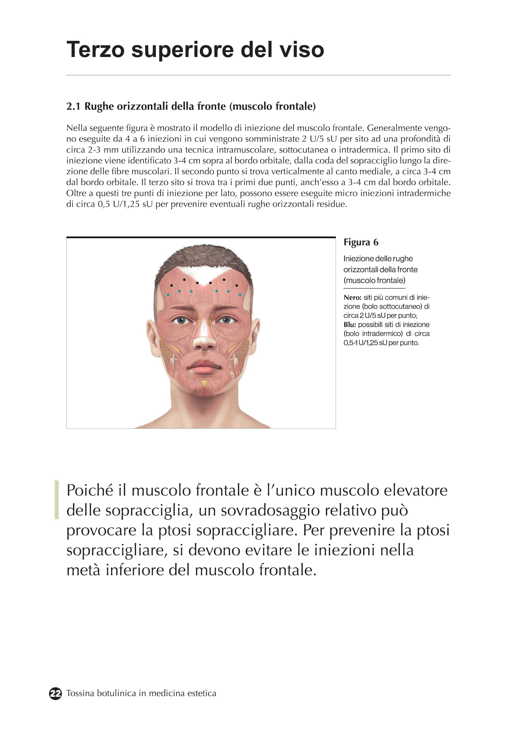 Tossina botulinica in medicina estetica. Protocolli iniettivi e gestione delle complicanze