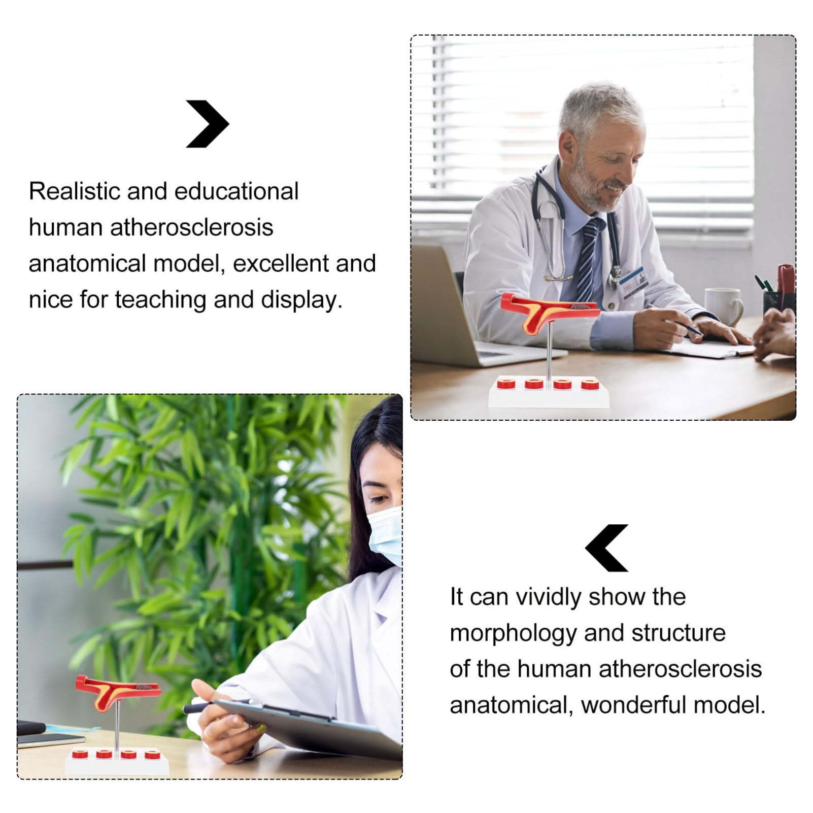 Ciieeo 3 Pezzi Modello Cardiovascolare Strumento Didattico Realistico per Educazione Medica Design e Sicuro per Ospedali e Studenti
