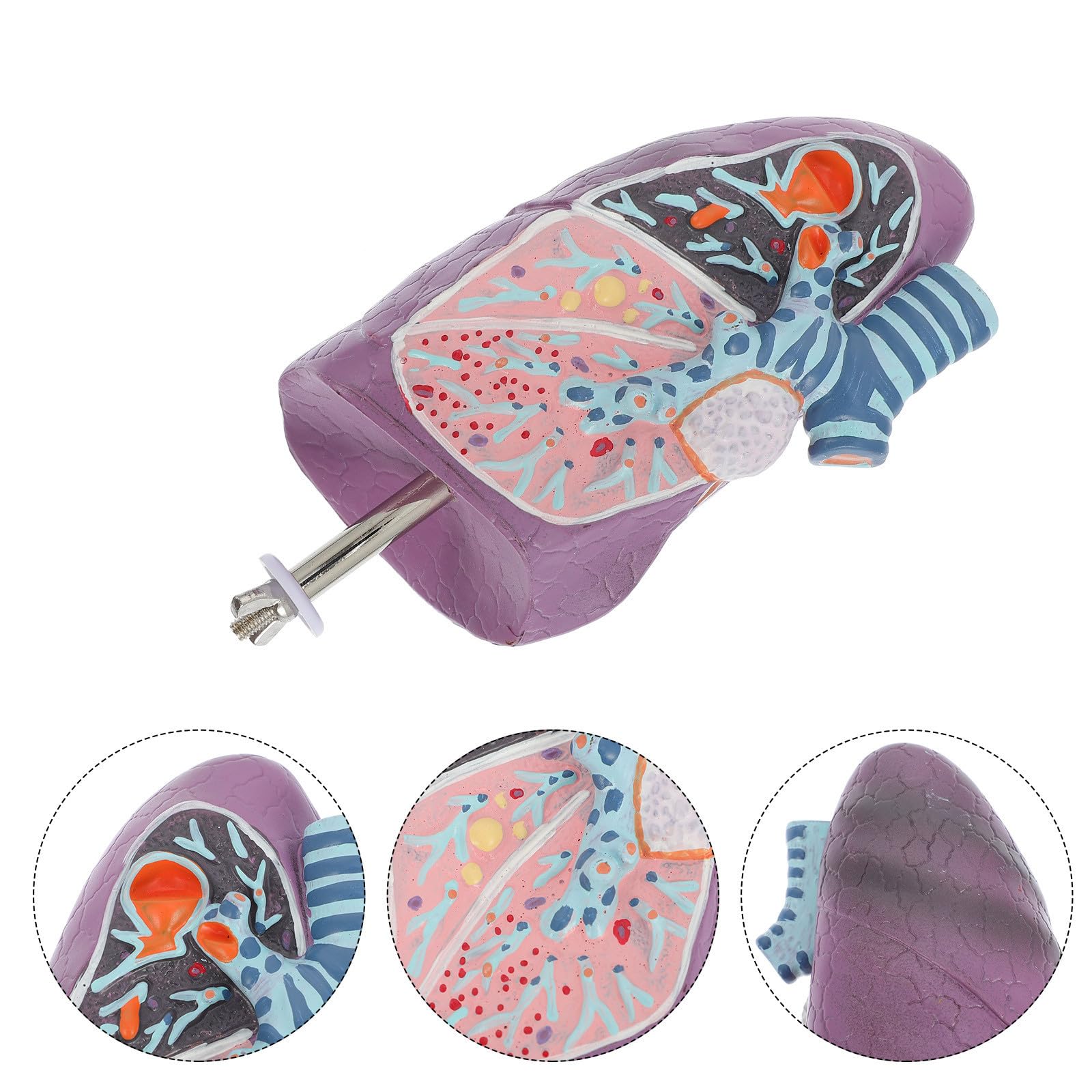 Modèle Physiologie de L'anatomie en Plastique pour Enseignement D'anatomie Pulmonaire Pathologique Réaliste Destiné aux Étudiants