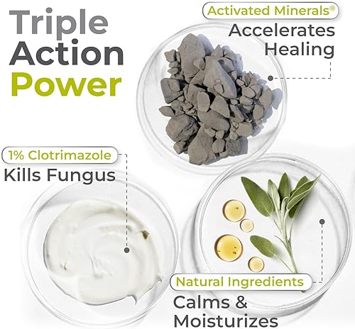 Miniatura 5 de terrasil Clotrimazole Antifungal Cream, Relief for Fungal Yeast Infections, Jock Itch, Athletes Foot, Ringworm for Men & Women, Clinically Proven