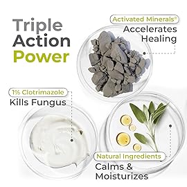 terrasil Clotrimazole Antifungal Cream, Relief for Fungal Yeast Infections, Jock Itch, Athletes Foot, Ringworm for Men & Women, Clinically Proven Treatment of Skin Fungus. FSA-HSA Eligible (1oz)