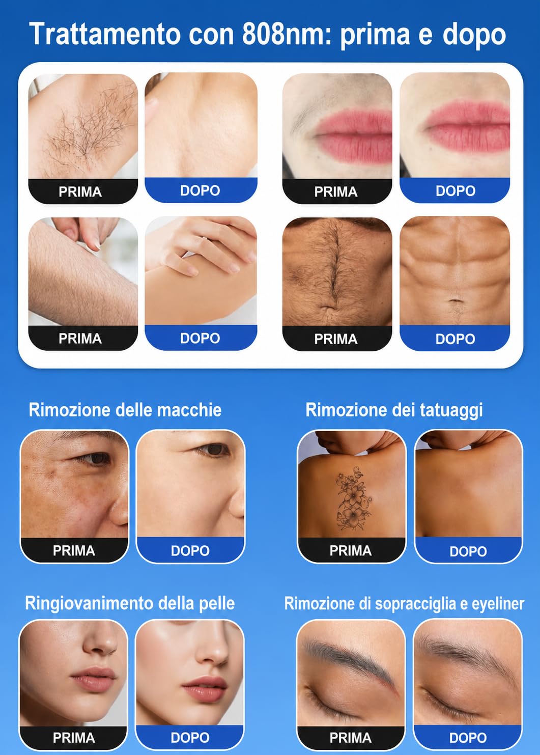 Dispositivo multifunzione 4 in 1 ad alta potenza per epilazione laser, rimozione dei peli e rimozione tatuaggi con laser a picosecondi, adatto per uso domestico/salone (nero).