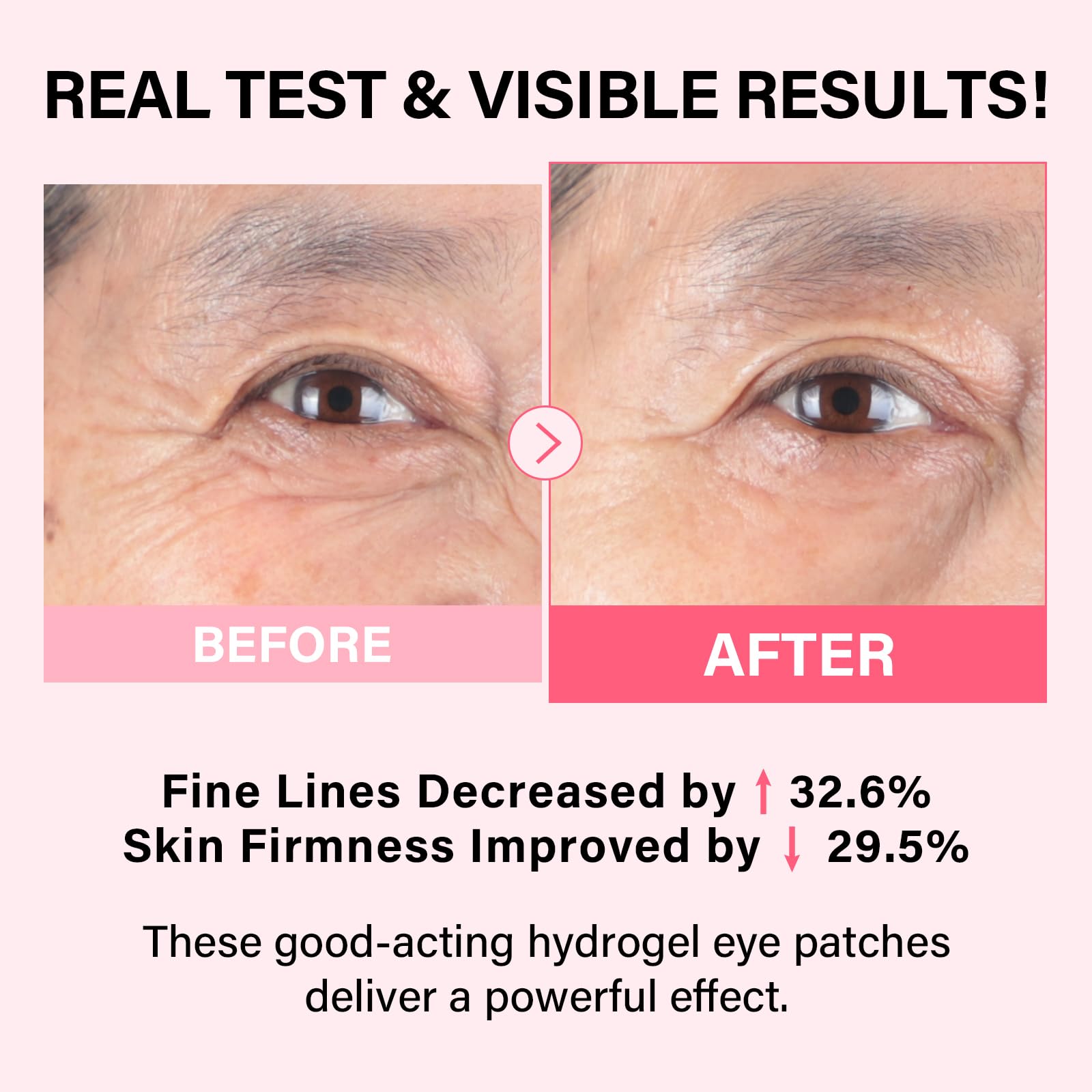 iMethod PDRN Collagen Boost Eye Patches – Under Eye Mask, Instant Lift Eye Mask per ridurre le linee sottili, rinforzare sotto gli occhi per cerchi scuri, occhi gonfi, 8 paia
