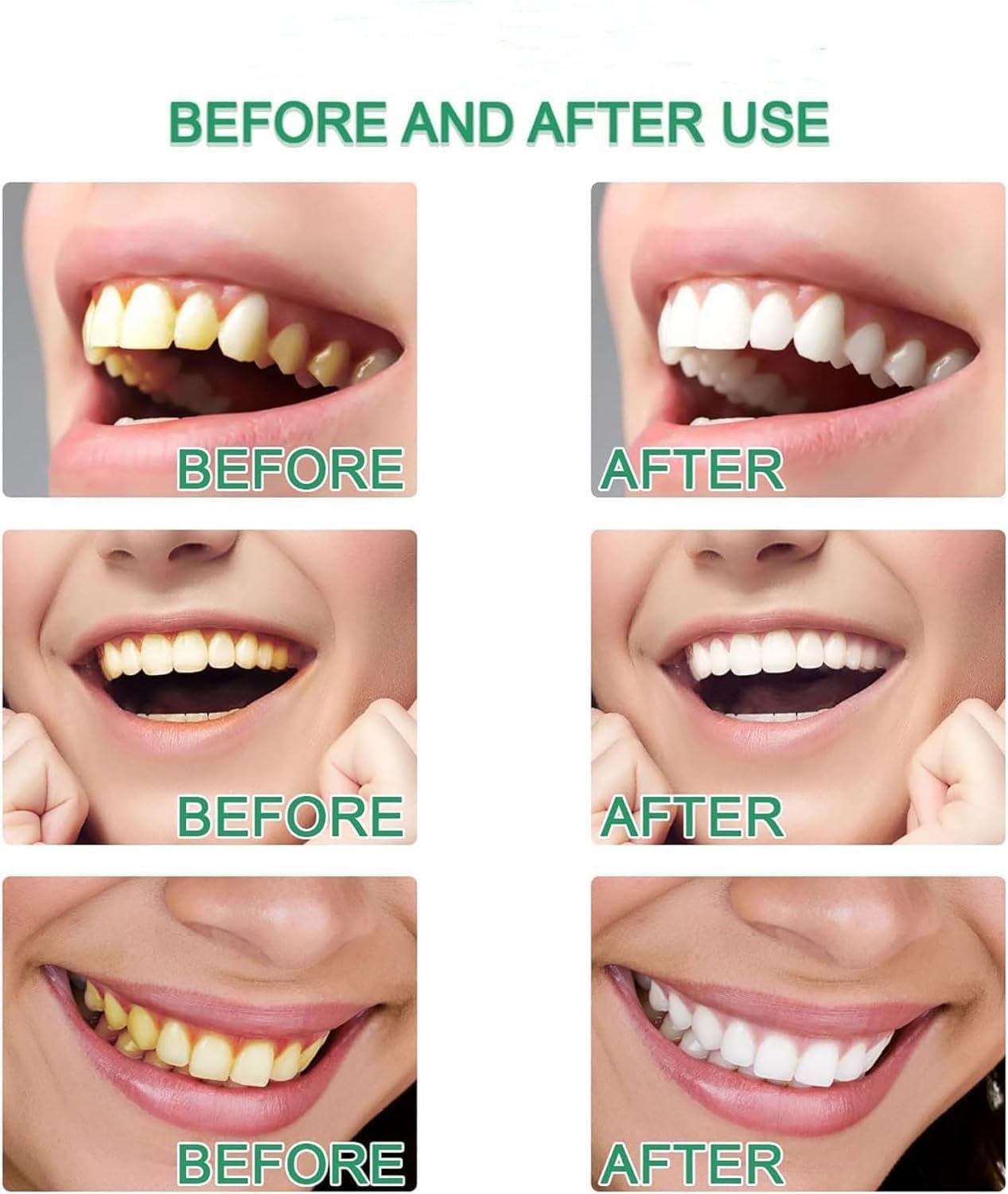 Niacinamide dentifricio sbiancante gel dentifricio niacinamide dentifricio smacchiatore naturale delicato pulizia profonda dentifricio radiante sbiancante per riparazione carie (5 pezzi)