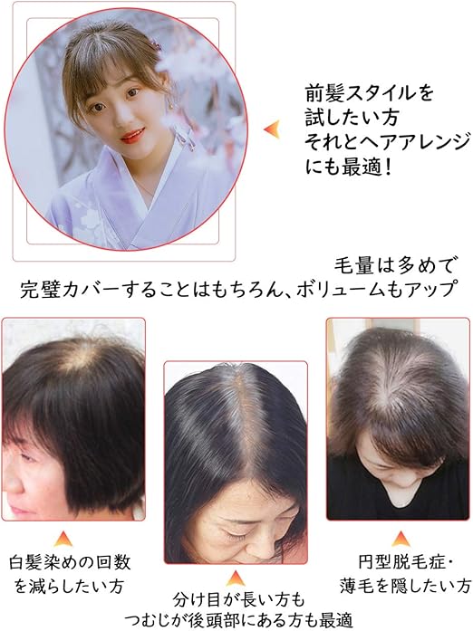 Amazon Hiye 前髪 部分ウィッグ 分け目専用 人毛100 超リアル人工皮膚 ウィッグ 自然 つむじ付き 総手植え シルクスキン ボリュームアプ 白髪 薄毛 隠す ポイントウィッグ 通販