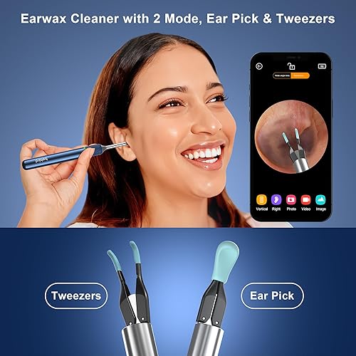 Miniatura 2 de BEBIRD Herramienta de eliminación de cera de oídos con cámara de oído, kit de limpiador de oídos con 2 modos de púa y pinzas, limpiador de oídos con