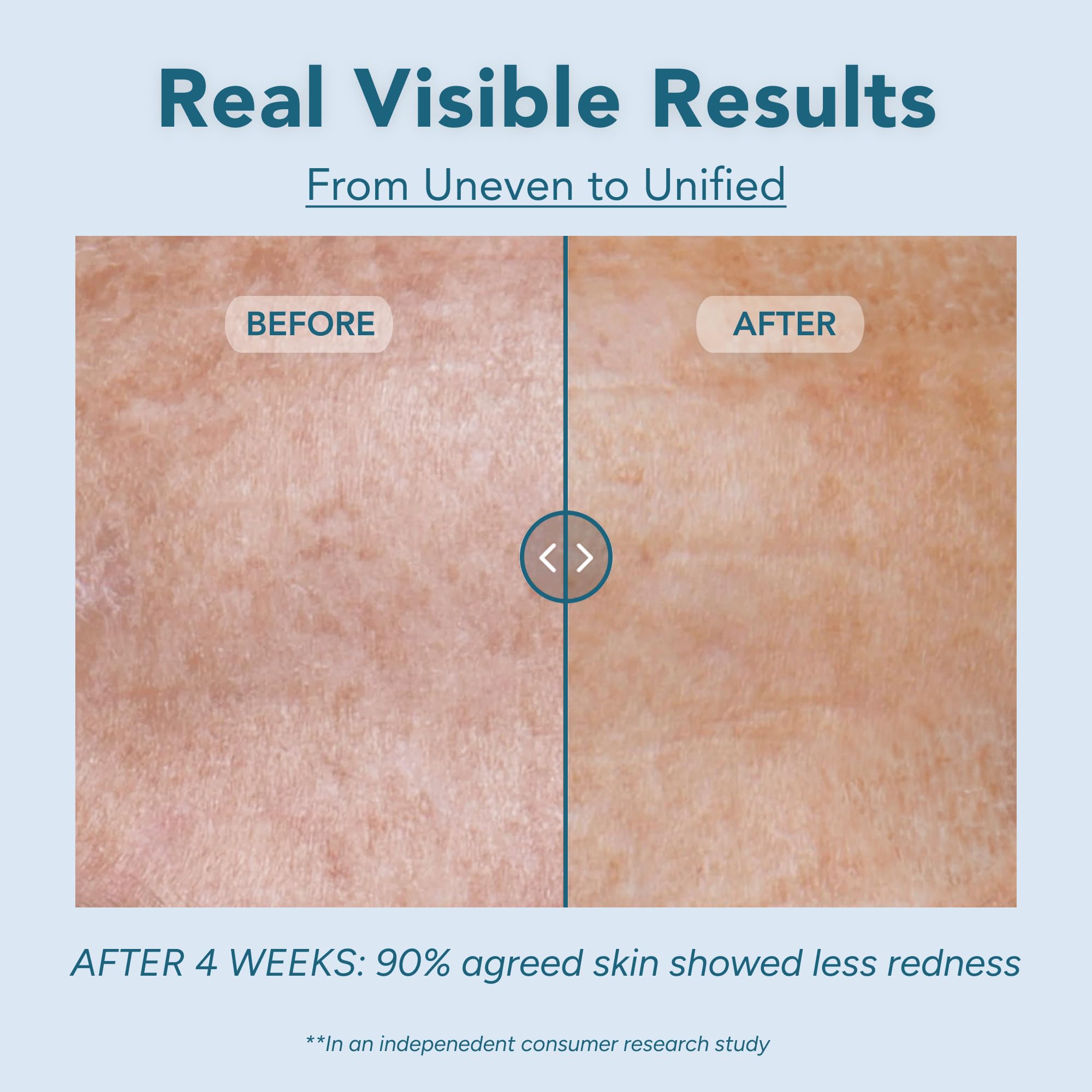 LANCER Gravity Dark Spot Correcting Serum, 1 oz – Brightening & Tone-Evening Serum with Exosomes, Alpha-Arbutin, Nonapeptide-1 & Gravityl for Dark Spot Reduction & Radiant Skin