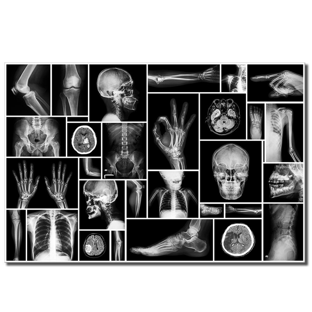 Black and White Human Skull Wall Art Canvas Painting XRay Picture