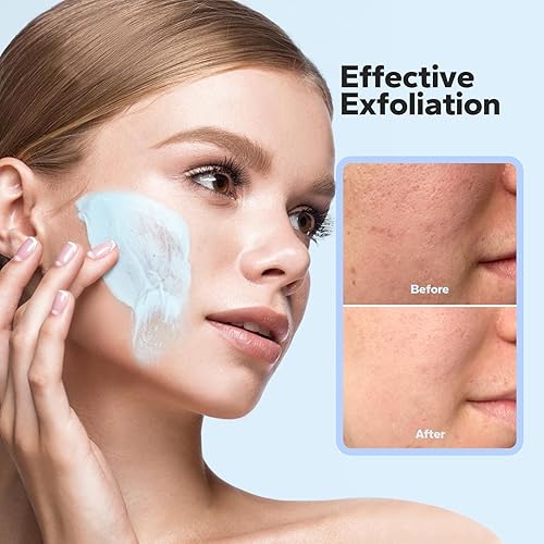 Miniatura 2 de Exfoliante facial de microdermoabrasión (4.23 onzas), exfoliante facial, exfoliante facial con piedra pómez natural, péptidos y extractos botánicos,