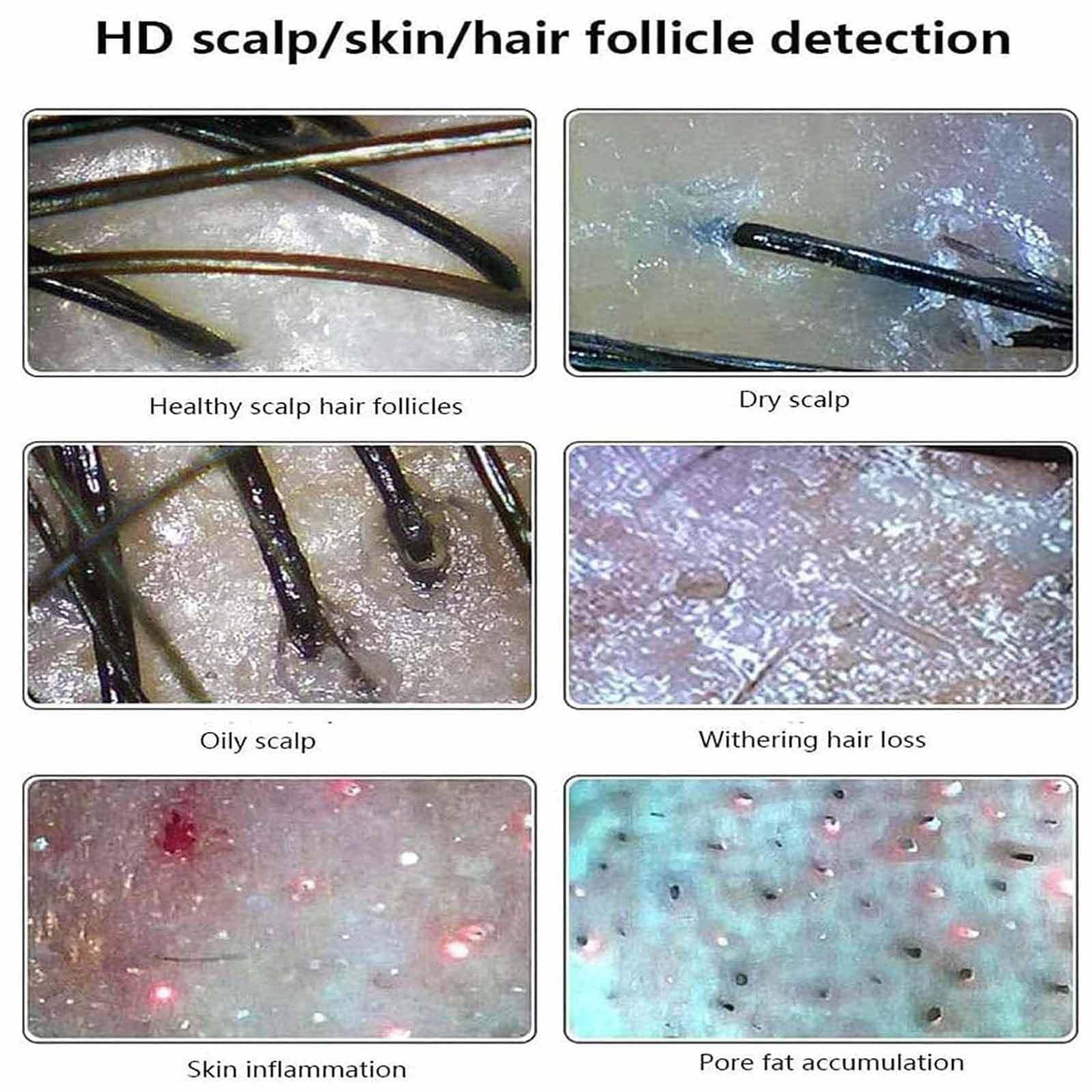 11 Zoll Haut Kopfhaut Detektor Haarfollikel-Hautanalysator-Maschine, Haarfollikel, Haut, Haardetektor, Analysegerät Multifunktionaler Digitaler Hautpflege-Analysegerät