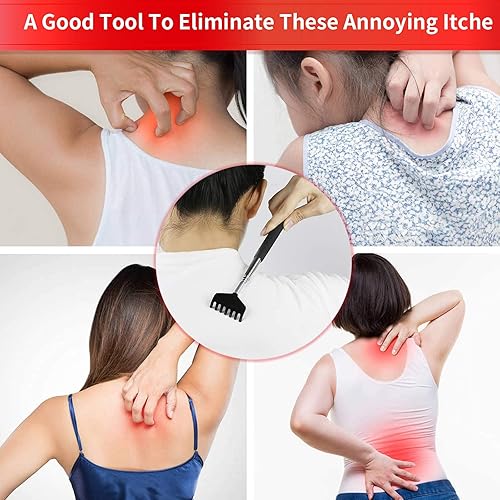 Miniatura 2 de SHINCEL Rascador de espalda extensible y retráctil, rascador de mano telescópico de metal resistente, masajeador divertido para aliviar la picazón,