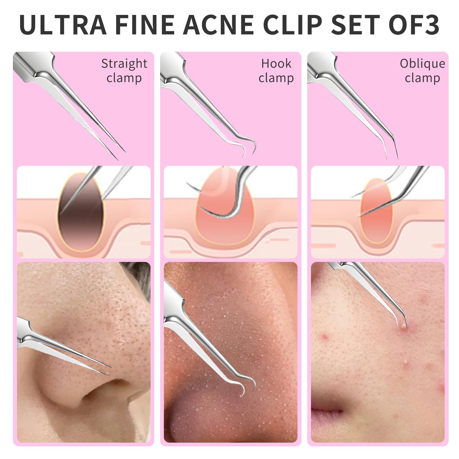 3 Piezas Pinzas de Punta Fina, Eliminación de Pinzas Blackhead Precisión Acero Inoxidable Depilar Punta Fina Profesionales para Espinillas Acné Cejas Pelo Encarnado (con Caja)
