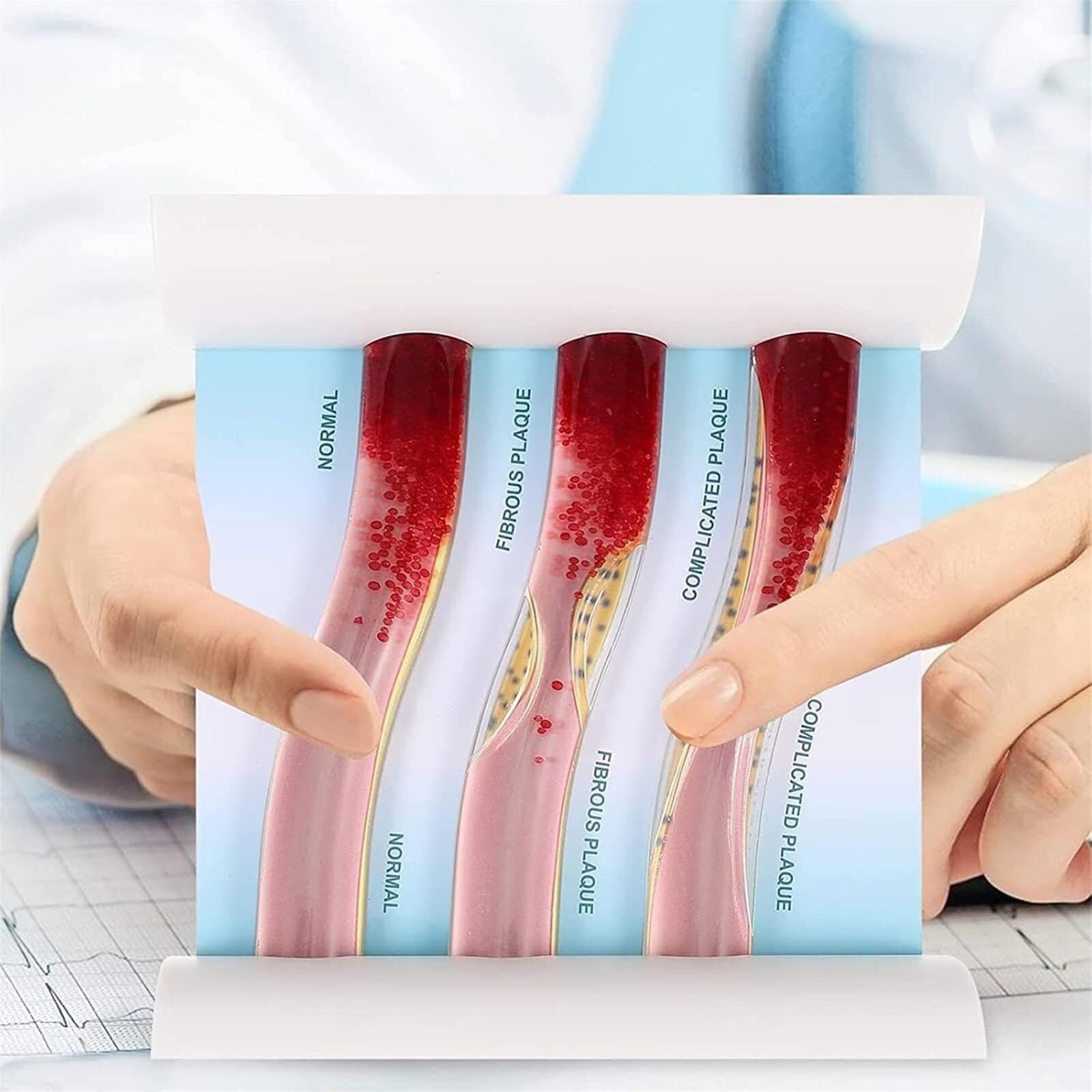 Human Blood Vessel Model Anatomy Model, LDL Blood Vessel Model, Teaching Tool to Promote Learning and Improve Understanding