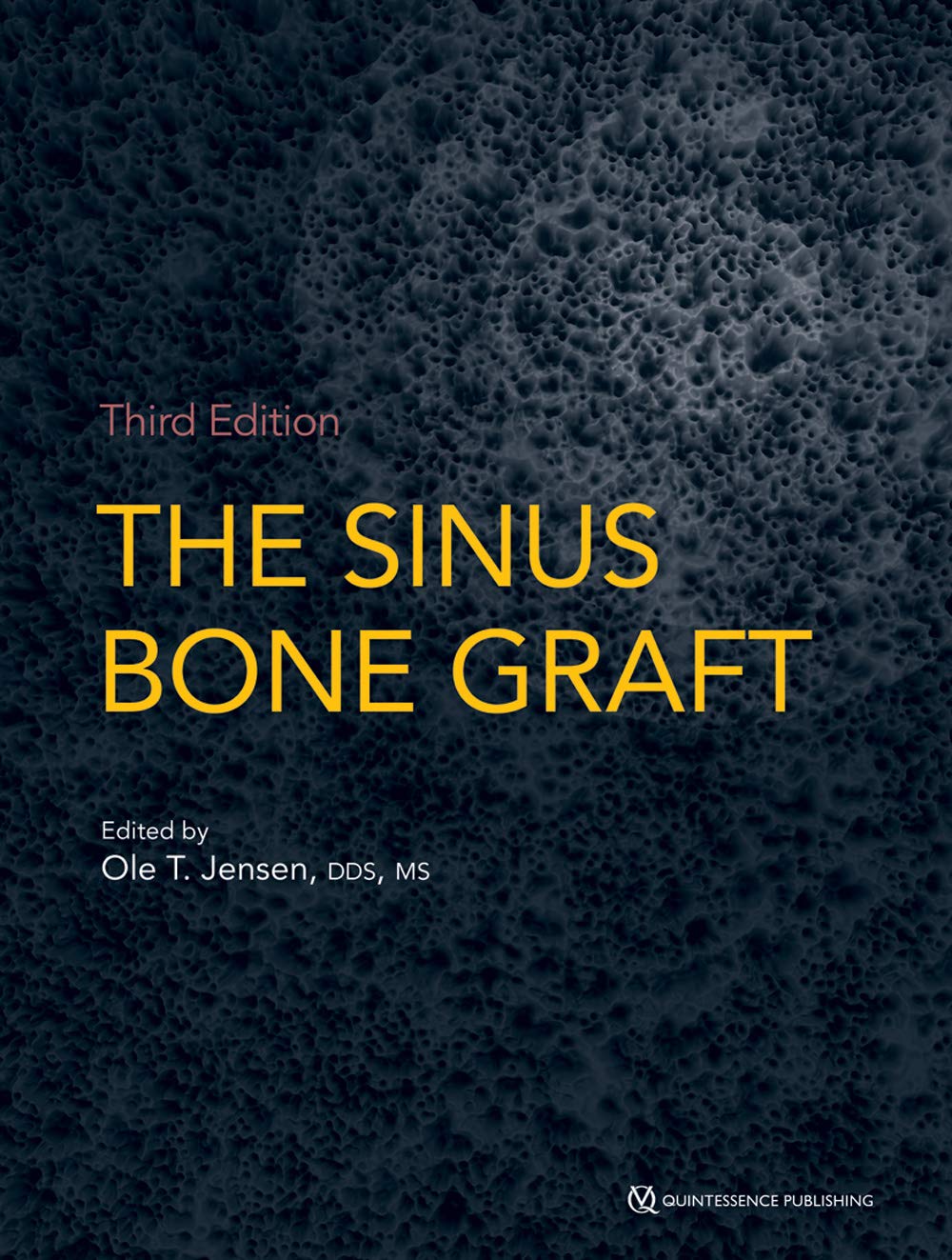 Buy The Sinus Bone Graft — BookShops.in