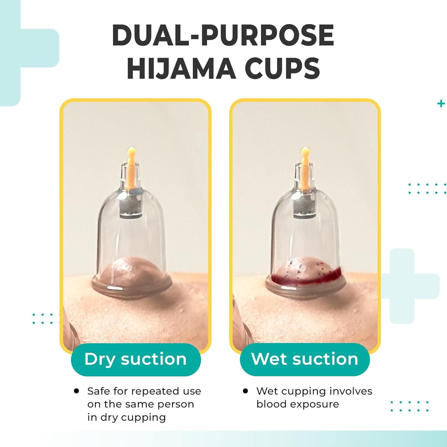 [100 Pack] Bulk Cupping Set for Massage Therapy - B1 B2 B3 B4 B5 B6 B7 U4 U5 - B6 (1.33 in) - Wholesale Professional Cupping Therapy Set, Cuppings Massage Kit, Physical Therapy Kit [No Pump Included] - Image 5