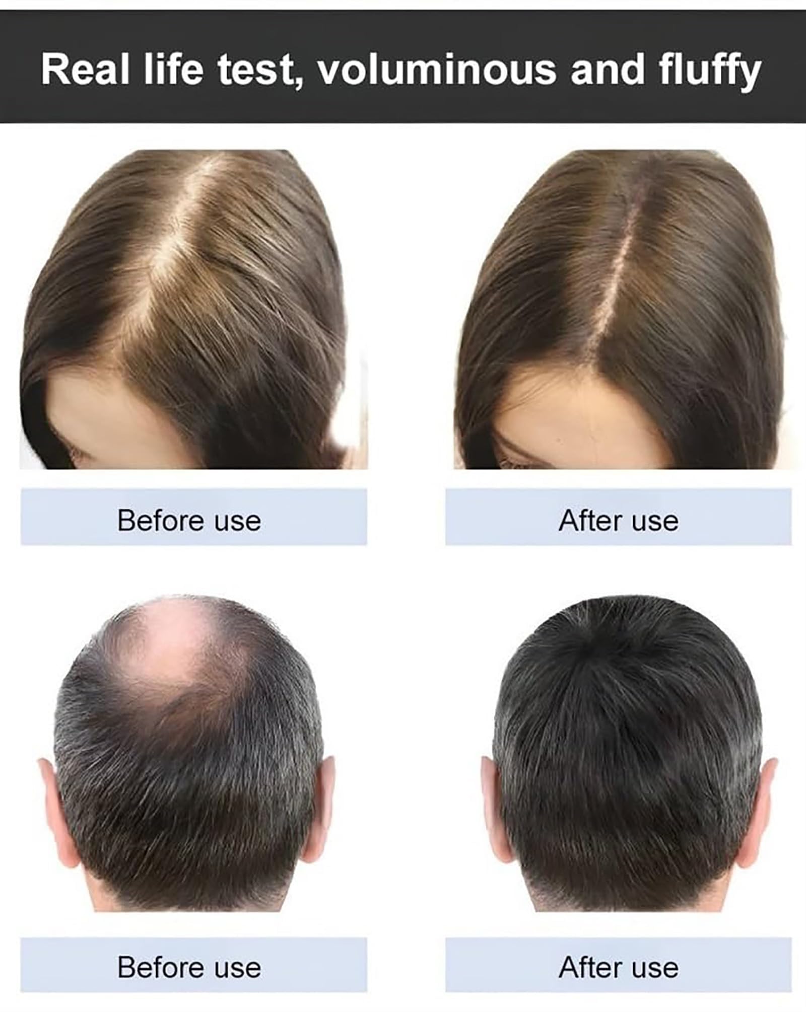 Champú nutritivo de raíz de ginseng, champú anticaída con control de aceite suave, champú anticaída para el crecimiento del cabello, fortalece el cabello