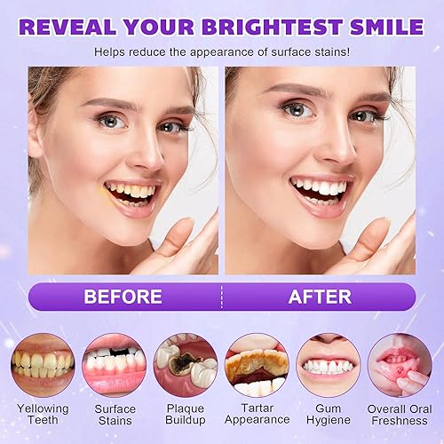 Miniatura 9 de Polvo blanqueador de dientes  Polvo blanqueador de dientes de nieve con fórmula Pap+, sin peróxido, sin sensibilidad y seguro para el esmalte,