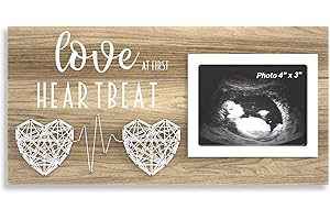 Ultrasound Picture Frame: Preserve Cherished Memories