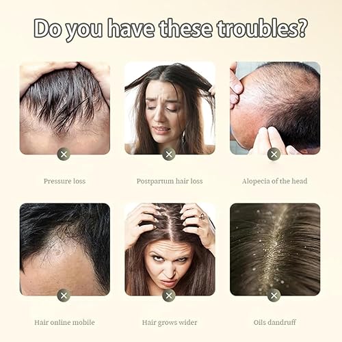 Miniatura 6 de Polygonum Multiflorum Ganoderma Atrum - Champú para el cabello anti-pérdida de cabello, champú para el control del aceite del crecimiento del